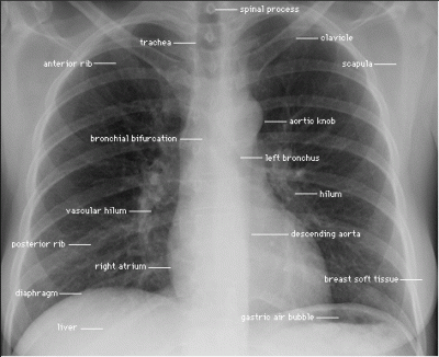 thorax-rtg-anatomi